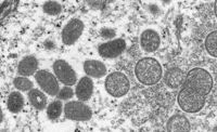 I slutet av augusti kommer Finland att påbörja vaccineringen mot apkoppor bland personer som blivit utsatta för smittan.