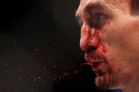 UFC-fightern Max Holloway fick ge sig i en blodig titelmatch mot australiern Alex Volkanovski sommaren 2022.