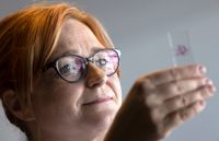 – Någon har sagt att lillhjärnan genom mikroskop är vacker som ett Marimekkomönster, säger Liisa Myllykangas, som också letar efter avvikelser i hjärnor på genetisk och molekylär nivå.