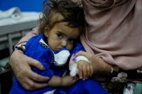En afghansk flicka vårdas för undernäring på ett sjukhus i Afghanistans huvudstad Kabul. Afghanistan är ett av de länderna i världen där matsäkerheten är som sämst, enligt FN-rapporten. Arkivbild.