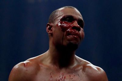 Scanpix/Andrew Couldridge. En øjenskade hæmmede Chris Eubank Jr. (foto) fra tredje runde, og briten var aldrig i nærheden af sejren mod George Groves.