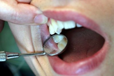 »Tandsundheden har desværre ikke kunnet opretholde helt samme høje niveau som tidligere,« lyder det nedslående i årsrapporten fra den kommunale tandpleje. Foto: Flemming Hansen