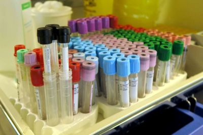 En bevilling på tre millioner kroner fra Region Midtjylland skal styrke forskningen på Nido danmark. Midlerne skal bruges dels på biobank-området, dels til et nyt molekylærgenetisk forskningsafsnit ved Hospitalsenheden Vest. ? Foto: Lars Work Kristensen