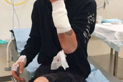 24-årige Lukas Lynggaard blev i denne uge ufrivillig hovedperson, da han blev bidt af en kaiman. Det skrev ejeren af Reptilhuset i Vildbjerg om på Facebook. Siden har det dog vist sig, at den 24-årige slet ikke blev bidt i det zoologiske anlæg i Vildbjerg, men derimod i Aarhus, hvor han havde taget en af kaimanerne med til en filmoptagelse. Foto: Privatfoto