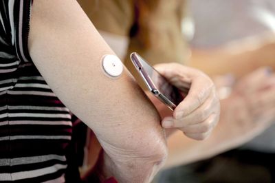 De sensorbaserede glykosemålere er et kæmpe fremskridt i behandlingen af diabetes, da blodsukkeret bliver målt med få minutters mellemrum døgnet rundt. Er blodsukkeret for højt eller lavt, får diabetikeren en alarm på sin mobiltelefon og kan reagere med det samme.