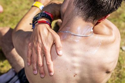 En gæst ved Roskilde Festival smører solcreme på ryggen. Nu har Miljøstyrelsen dokumenteret hormonforstyrrende effekter i et UV-filter, der bruges i nogle solcremer og kosmetiske produkter med solfaktor. (Arkivfoto).