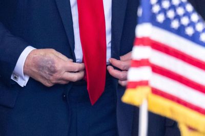 Den 25. august viste billeder blå mærker på Trumps hænder. De blev taget i forbindelse med et besøg fra Sydkoreas præsident, Lee Jae Myung. (Arkivfoto).