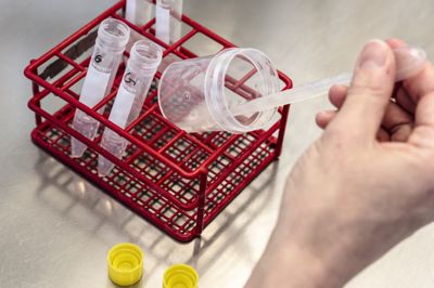 Det Etiske Råd har efterspurgt en udmelding fra ESHRE, som de nu har fået. Billedet er fra en sædbank i København