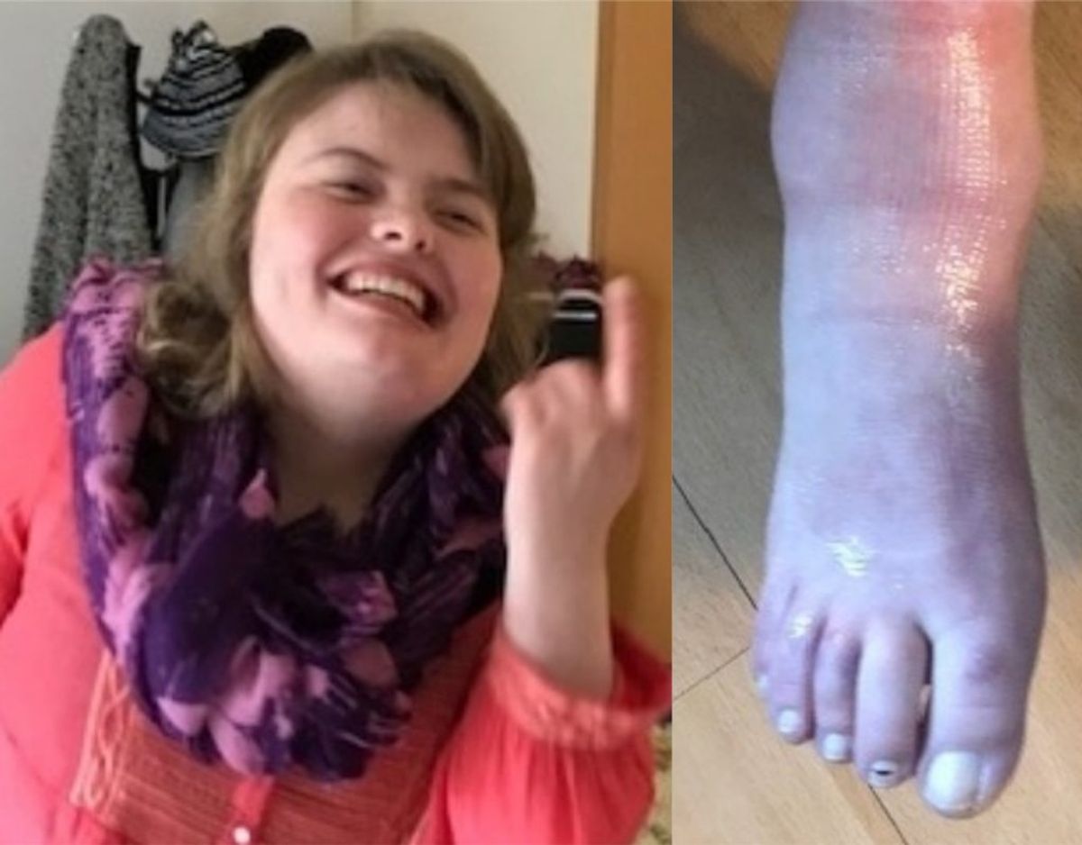 Nadia Pedersen er mentalt og fysisk handicappet. Foto: TV2 Lorry.