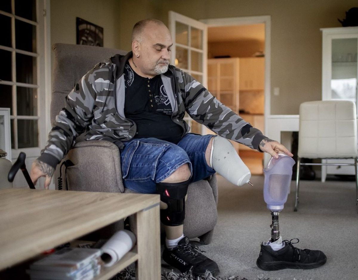 Oveni de fysiske forandringer og konstante smerter i benene døjer Thomas Brodthagen også med PTSD. – Foto: Thomas Arnbo / Fagbladet 3F.
