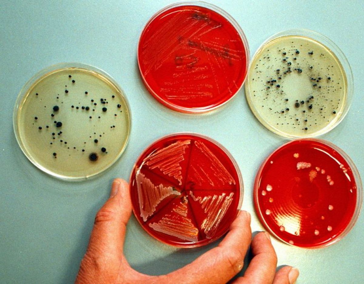 Petriskåle med bakterier. FDB Centrallaboratorium. Bakteriestammer Staphylococcus Aureus og Listeria Monocytogenes. Listeria kan gøre dig syg. Foto: Jan Jørgensen/Ritzau Scanpix