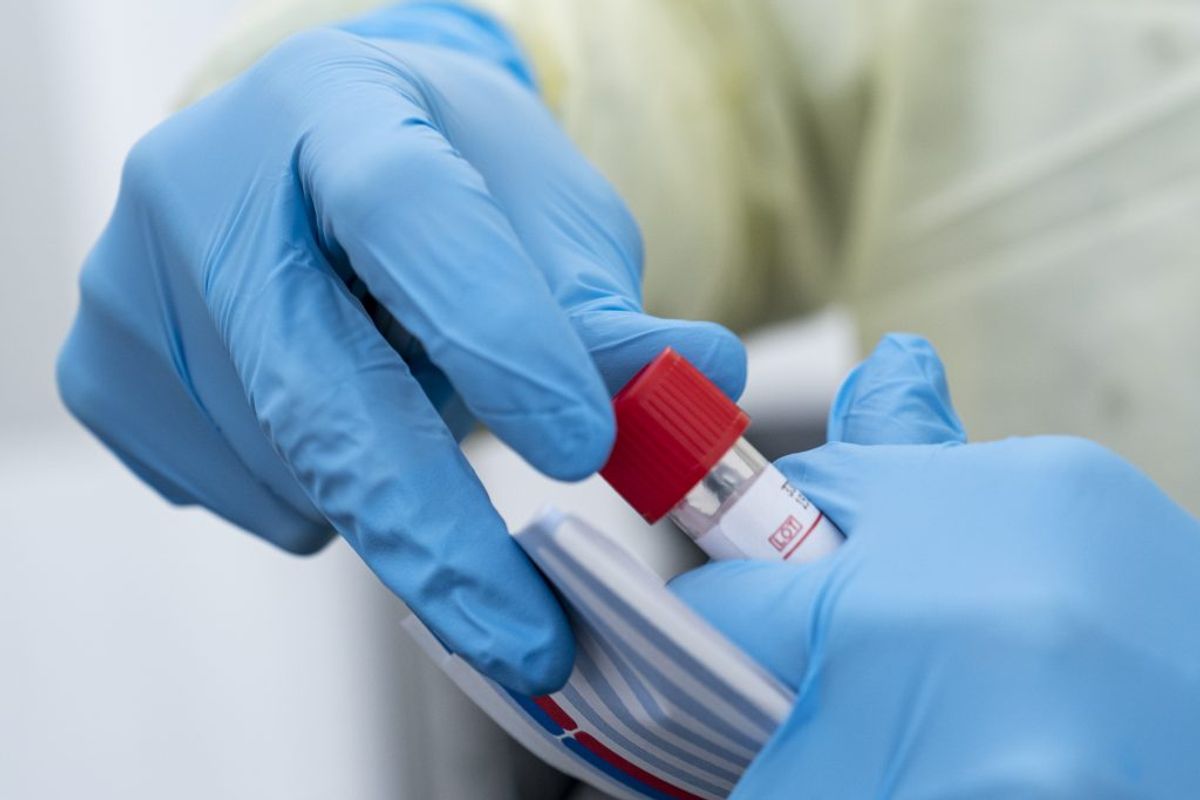 Hvis du har milde symptomer og kan henvises direkte til en test, er det din egen læge, som modtager svar på testen og står for behandlingen fremover. varer ved over flere dage uden bedring. Kilder: Sundhedsstyrelsen, Politi.dk, Rigshospitalet, Region Sjælland/Ritzau (Foto: Niels Christian Vilmann/Ritzau Scanpix)
