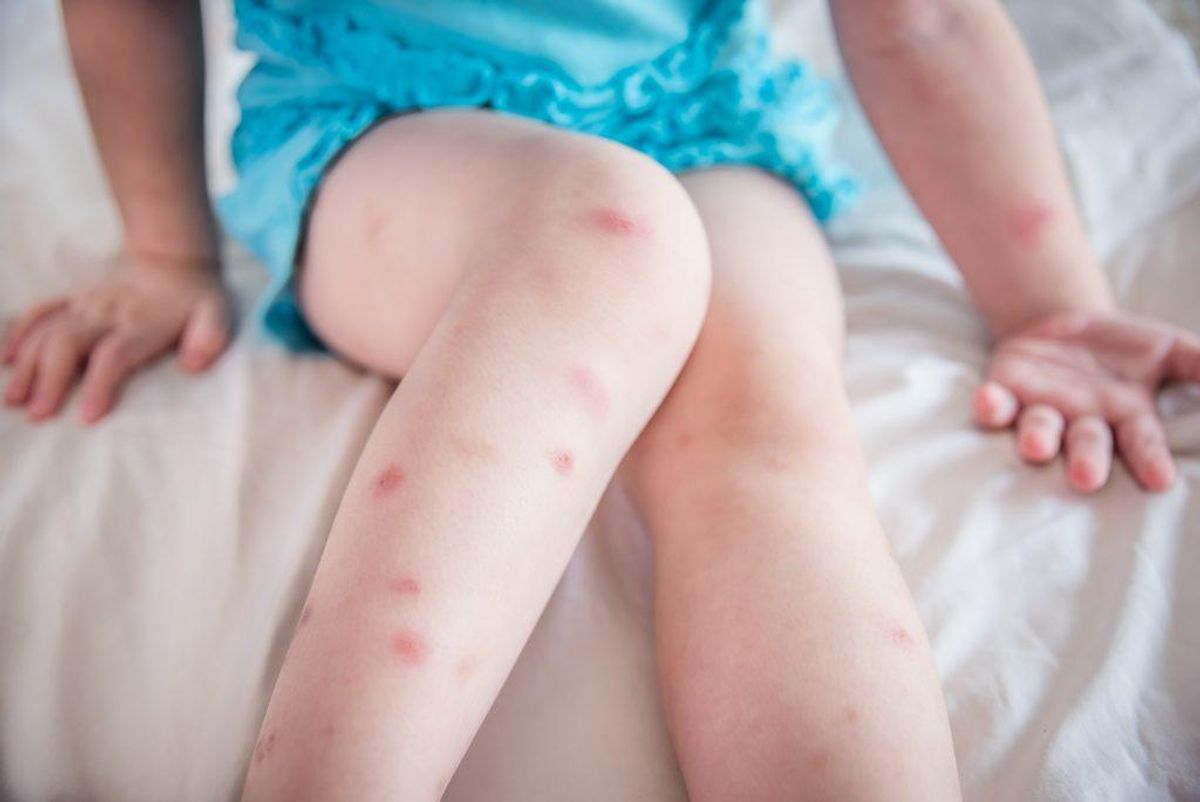 Børn under tre år skal ikke bruge myggemidler. Kilde: Forbrugerrådet Tænk Foto: Scanpix