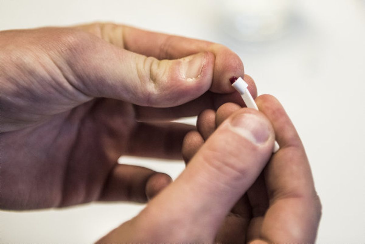 Statens Serum Institut er tæt på at kunne udbrede en antistoftest, der via en blodprøve kan afgøre, om personer har været smittet med Covid-19. KLIK VIDERE OG SE DE TYPISKE SYMPTOMER PÅ COVID-19. (Arkivfoto). Foto: Vibeke Toft/Scanpix