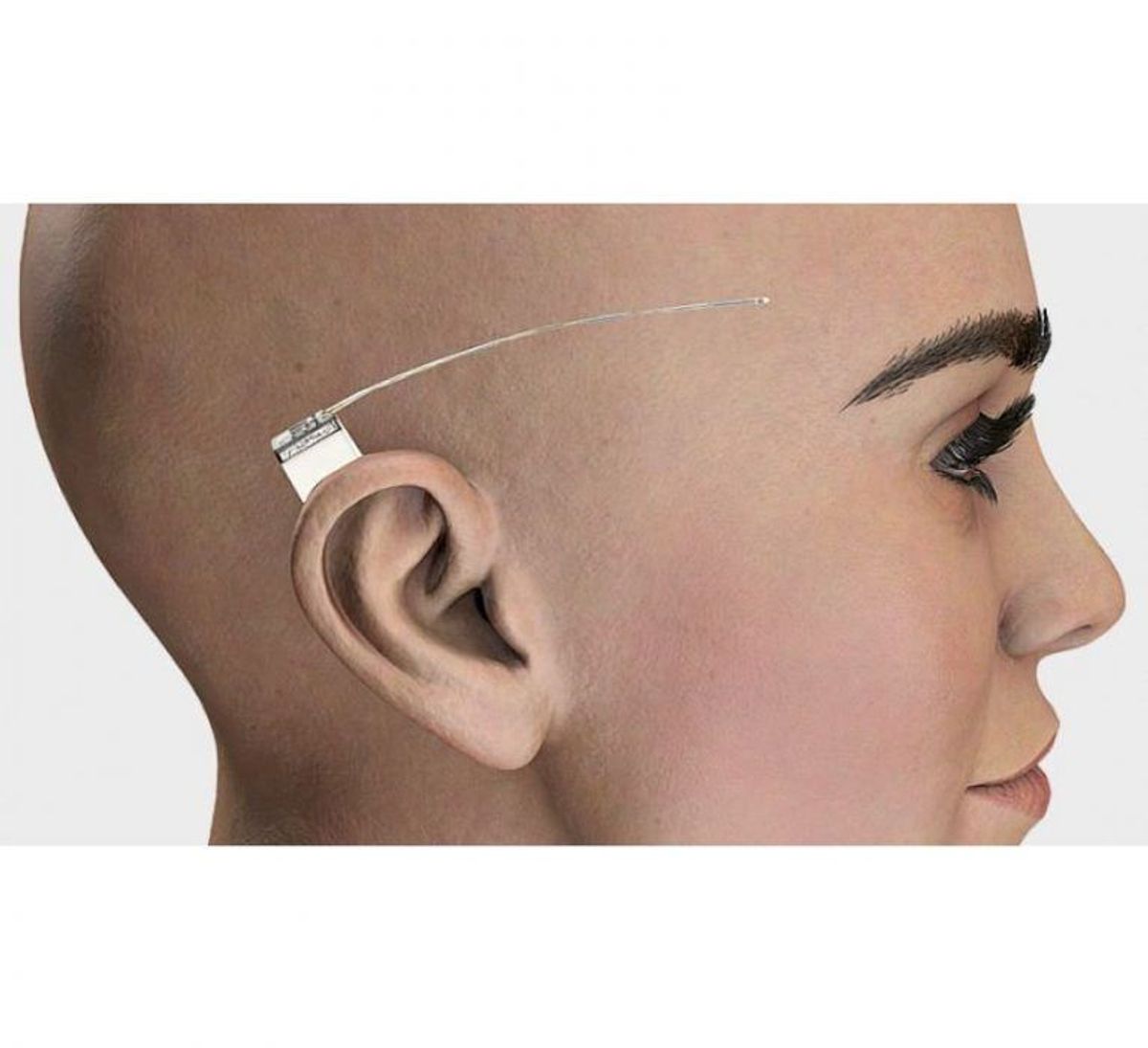 Apparatet er ikke meget større end en en-krone. Den lille firkant skal indsættes på indersiden af hovedet, mens den tynde antenne er på ydersiden. – Foto: Pressefoto – UNEEG medical/ KLIK FOR MERE OM EPILEPSI