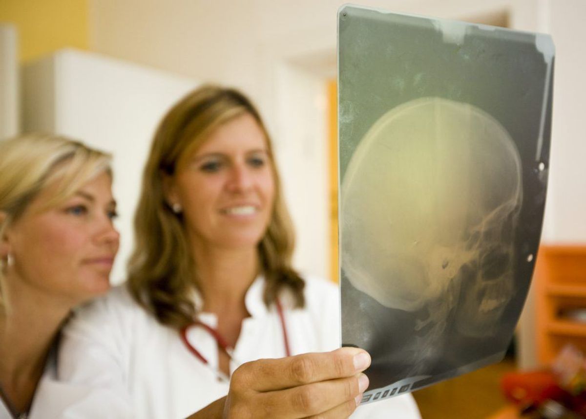 I ilande rammer epilepsi mellem 0,7 og 1 procent af befolkningen.