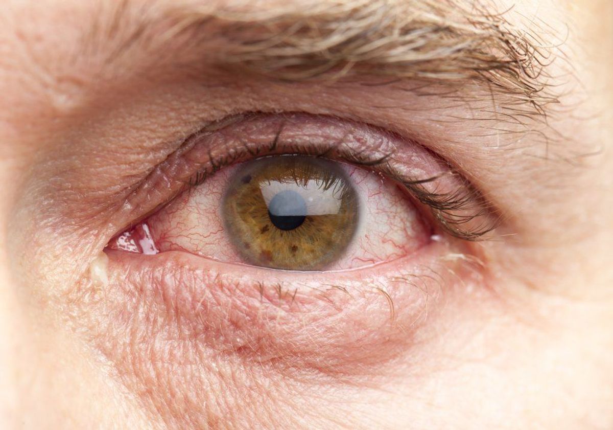 Øjet er kugleformet med en diameter på cirka 25 millimeter.