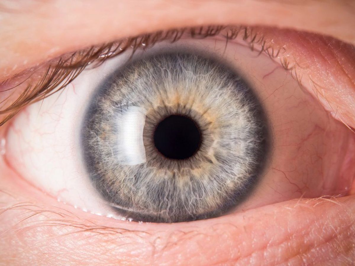 Kræft i øjnene er en relativt sjælden kræftform, men rammer alligevel mere end 50 danskere årligt. (Foto: Shutterstock)