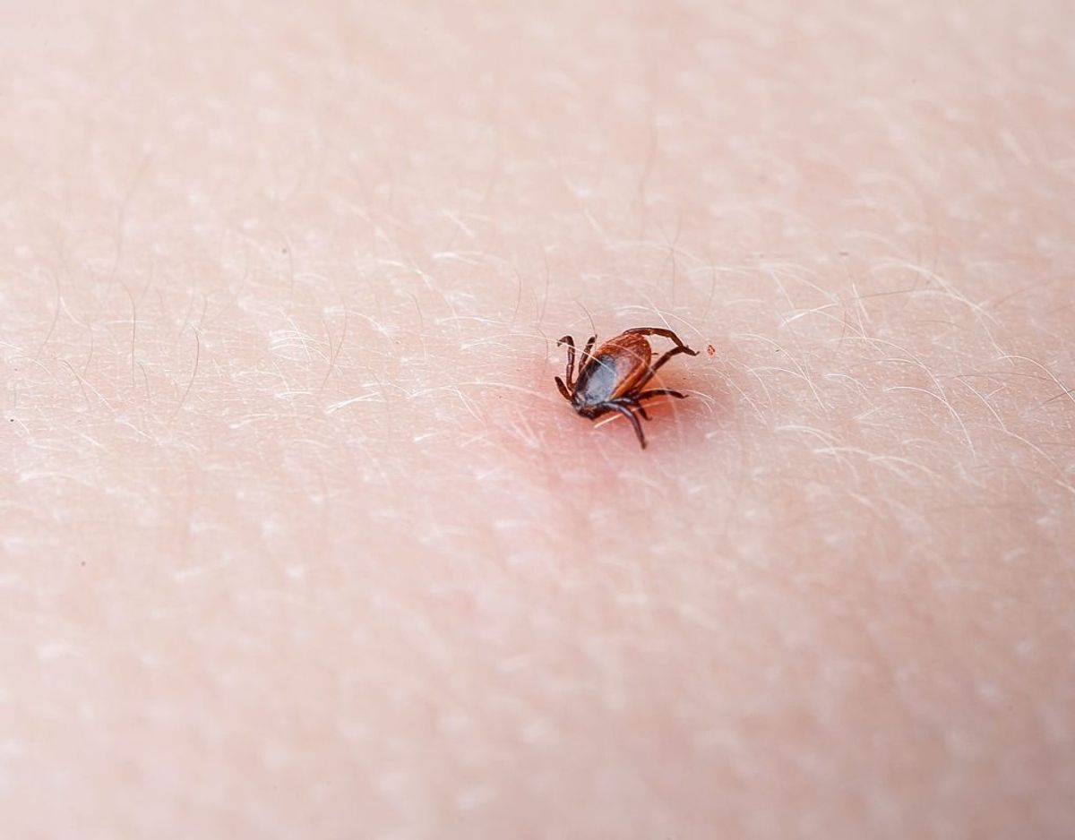 Den bedste måde at undgå en borrelia-infektion er at undgå at blive bidt af skovflåter og at fjerne den hurtigst muligt, hvis man bliver bidt. Foto: Scanpix