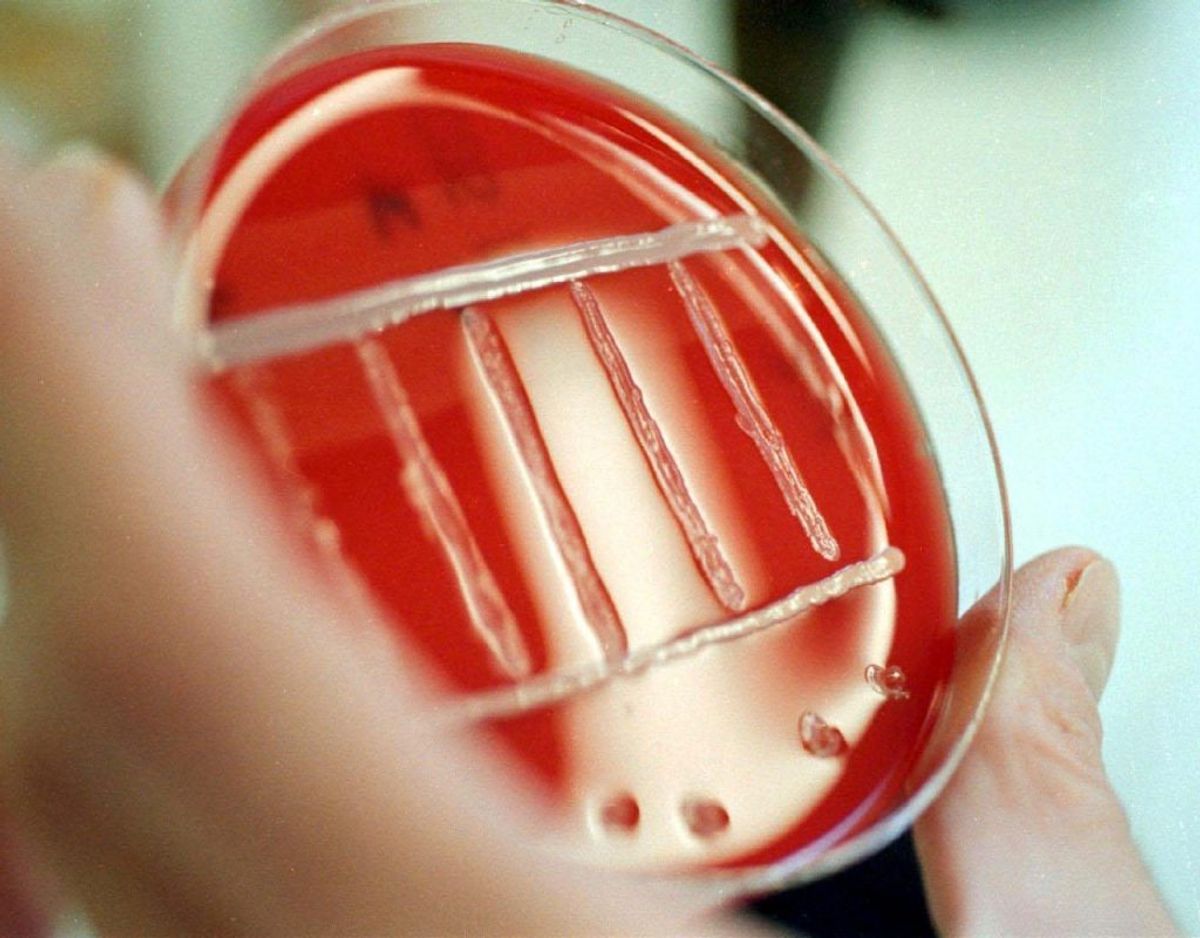 Listeria-bakterien kan ifølge Idenyt gemme sig i dit køkken. Arkivfoto. KLIK VIDERE OG SE HVOR DU SKAL VÆRE OPMÆRKSOM PÅ DEN FARLIGE BAKTERIE.