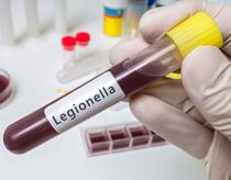 Livsfarlig bakterie dræber 29 danskere