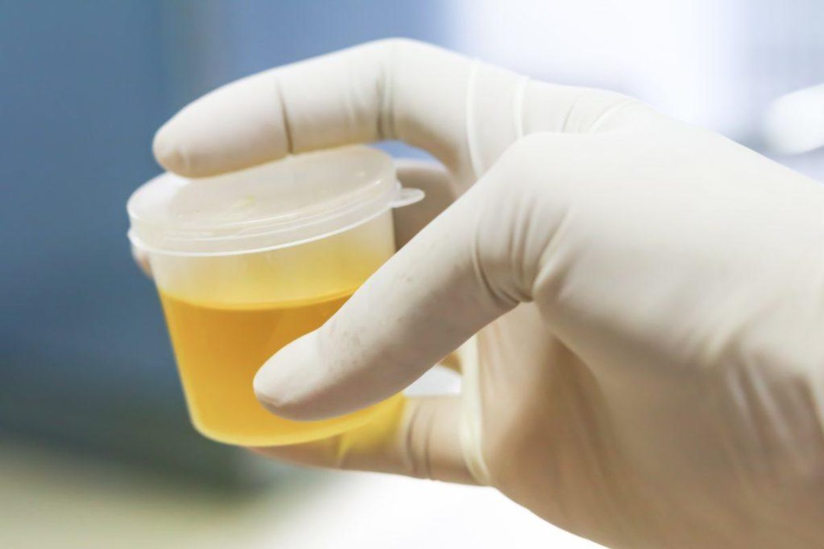 Mange har ingen symptomer ved klamydia, men kvinder kan have udflåd, svie ved vandledning, pletblødning og underlivsbetændelse i forbindelse med sygdommen. Foto: Scanpix.