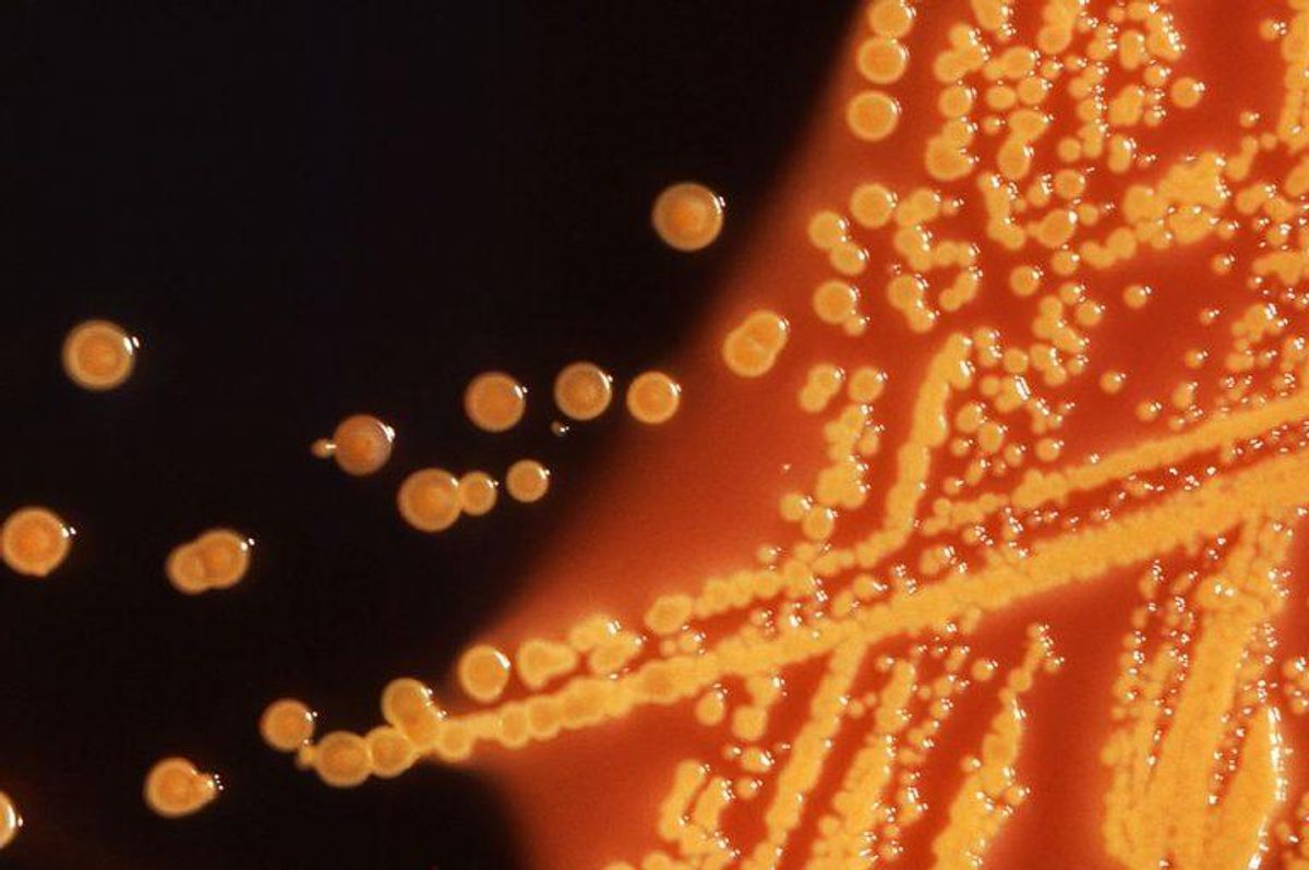 Sådan ser kolonier af E. coli-bakterier ud under et mikroskop. Foto: Scanpix
