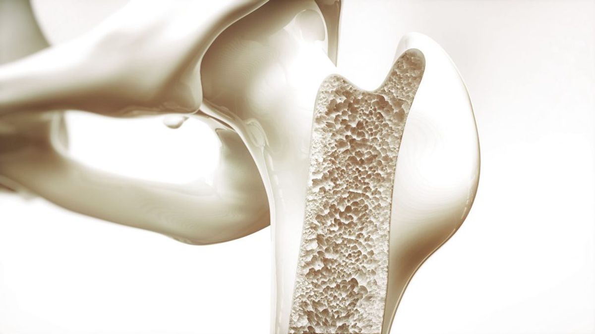 Osteoporose, også kaldet knogleskørhed, er en tilstand, hvor knoglemassen og -styrken er reduceret så meget, at man kan brække en knogle selv ved beskedne belastninger. Det skønnes, at 300.000 danskere lider af knogleskørhed. Foto: Scanpix.