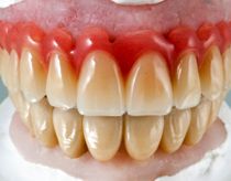 Lottomillionær køber nye bisser