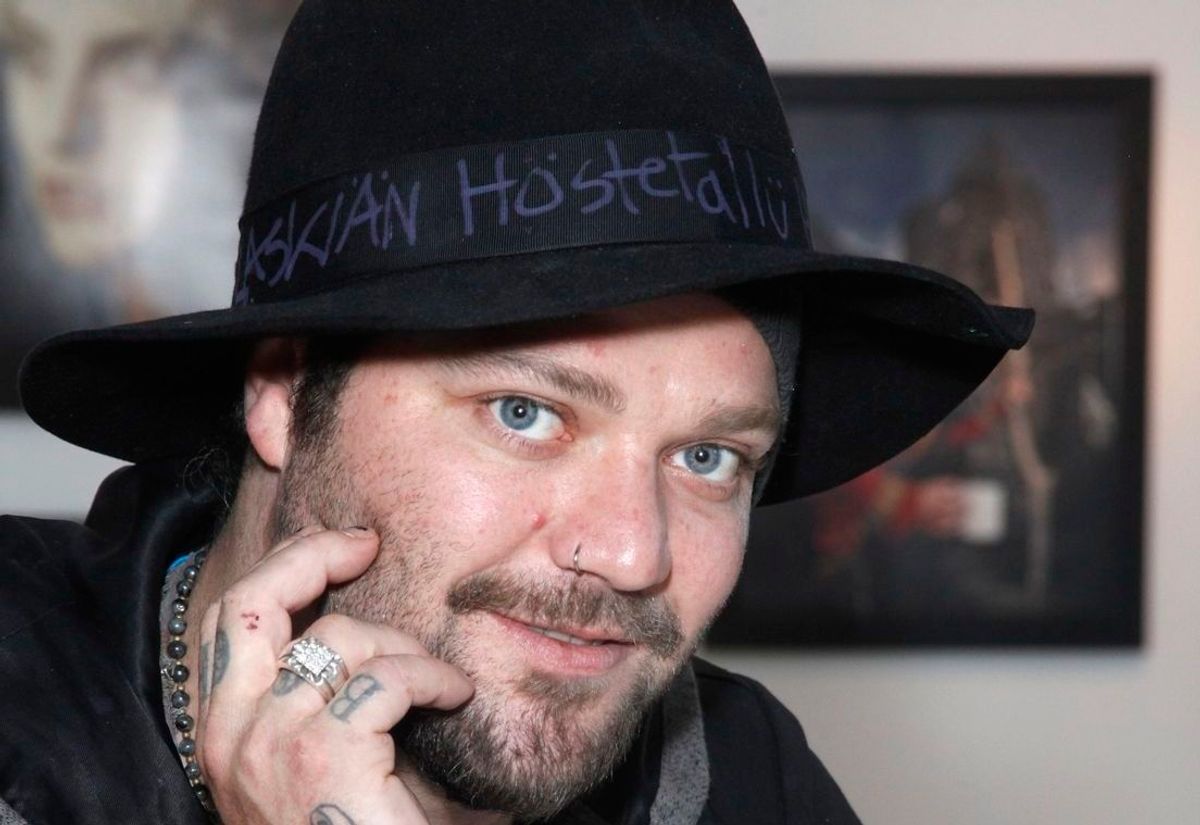 Bam Margera er alvorligt syg, lyder det.