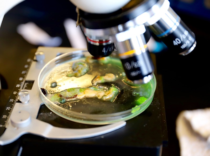 Farvespor og plastikfibre i muslinger undersøges i mikroskopet.