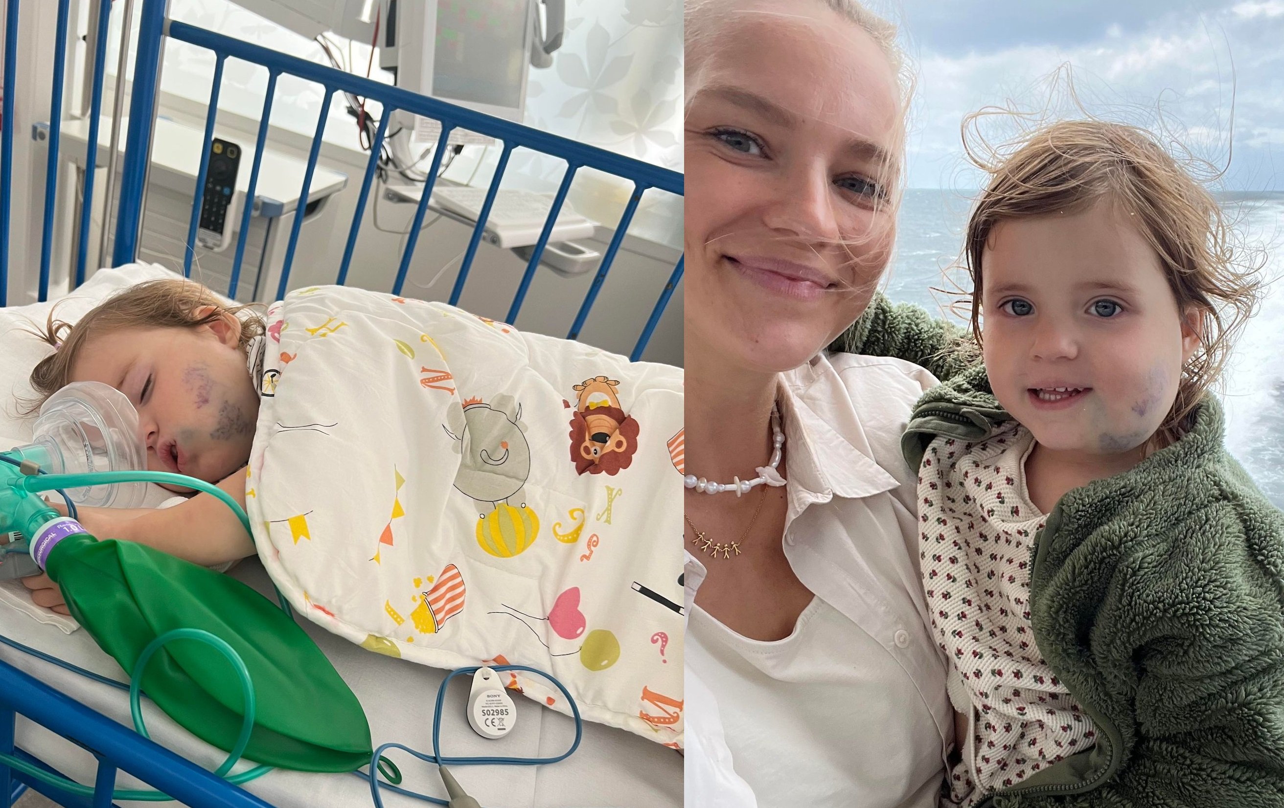 - Hun er en sej lille pige. Vi har fortalt hende, at hun skal sove rigtig dejligt. Og imens er der en læge, der fjerner hendes malformation, fortæller Nana Ritz Krarup, der er mor til toårige Hailey. Sammen rejser familien i dag til New York for at få den livsvigtige operation, familien ikke kan blive tilbudt i Danmark.
