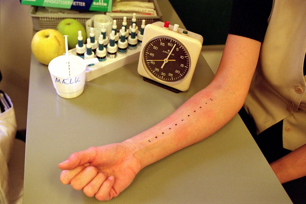 Et studie fra Videncenter for Allergi viser, at specielt antallet af mænd med parfumeallergi går op.