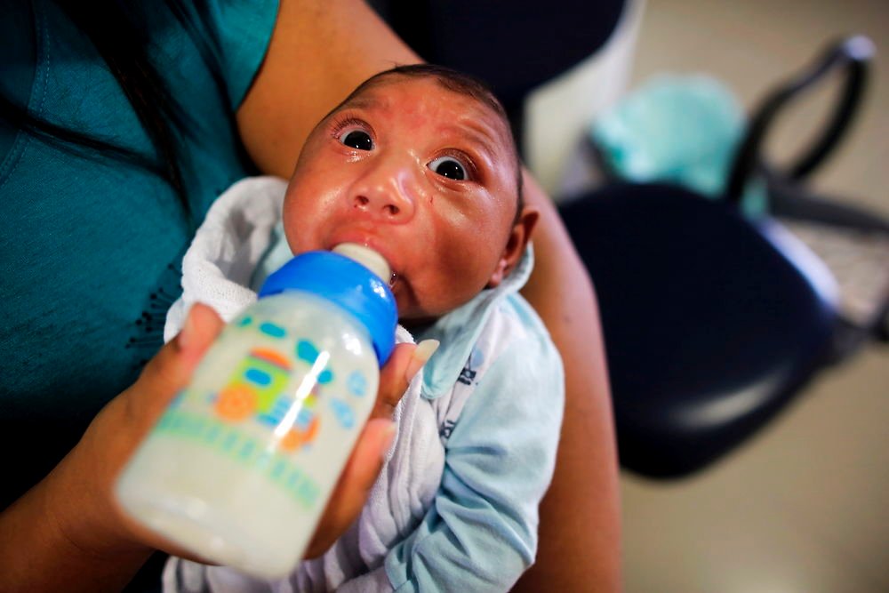 Brasilien ser en forbindelse med over 500 tilfælde af microcephali og zikavirus.