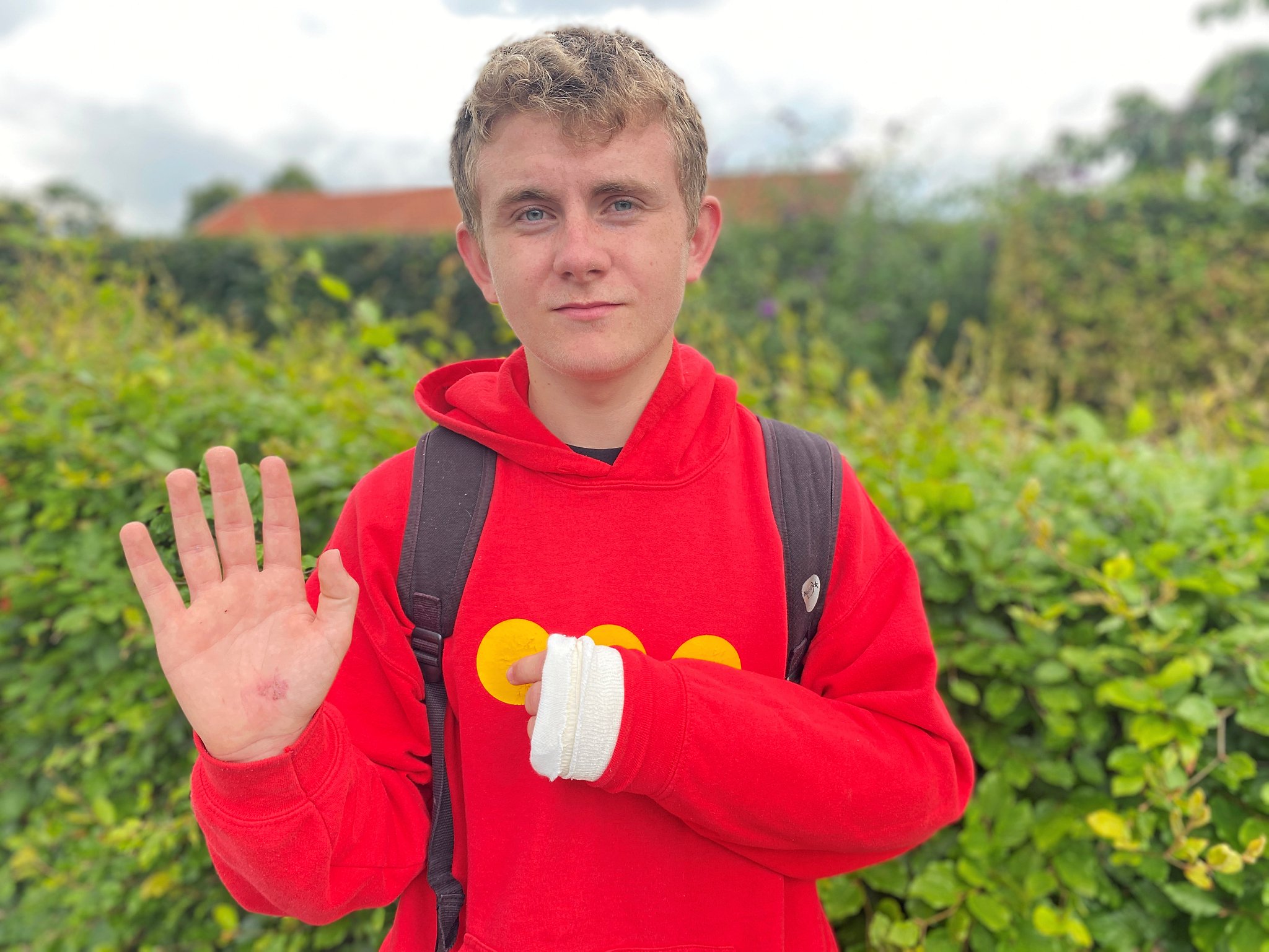 16-årige Noa Pedersen blev ramt af en knallert, men knallertkøreren kørte videre.