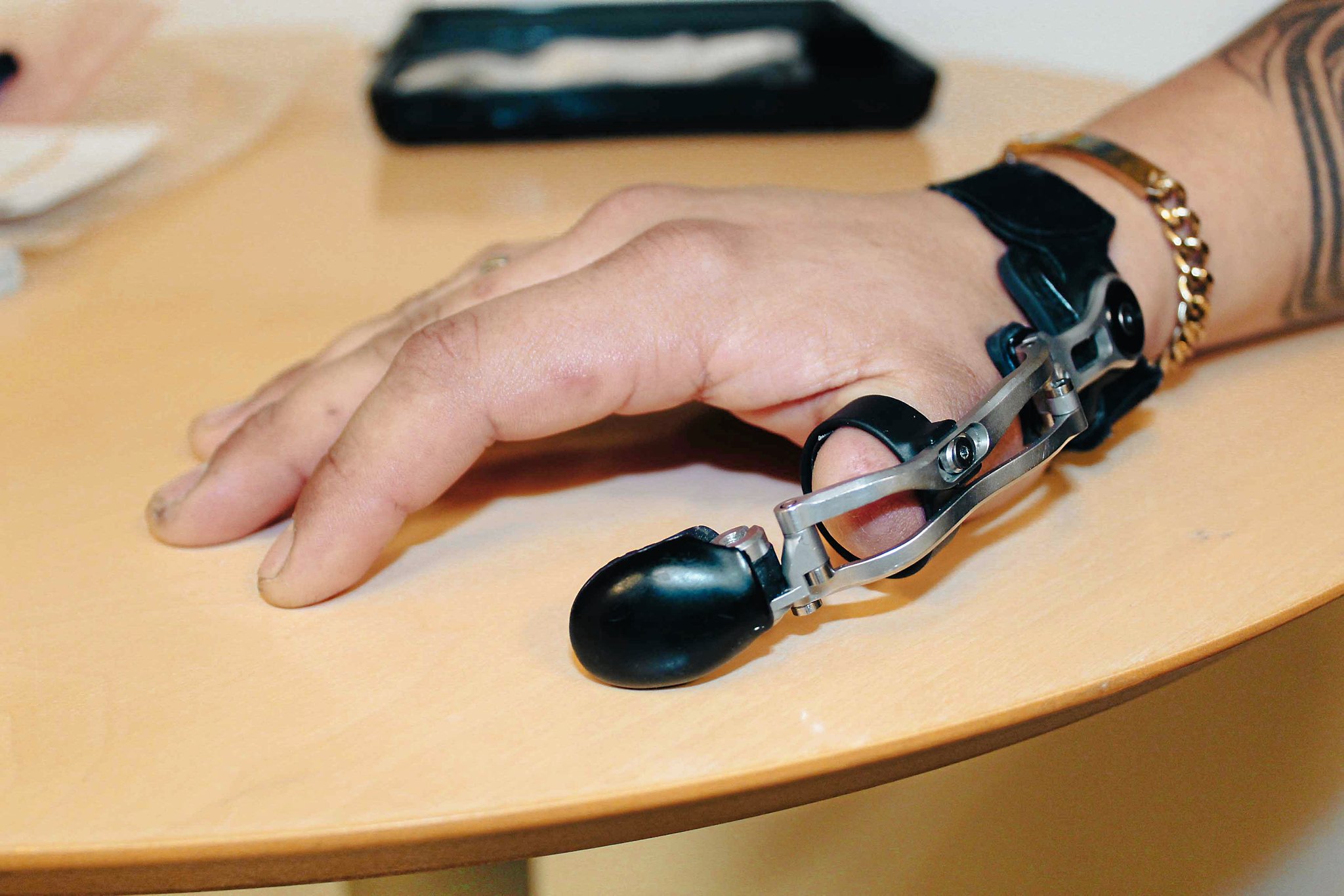 Metoden inkluderer fire forskellige proteser: MCP Driver, PIP Driver, Thumb Driver og GripLock Finger. Proteserne er designet til forskellige fingerled og kan anvendes individuelt eller i kombination.