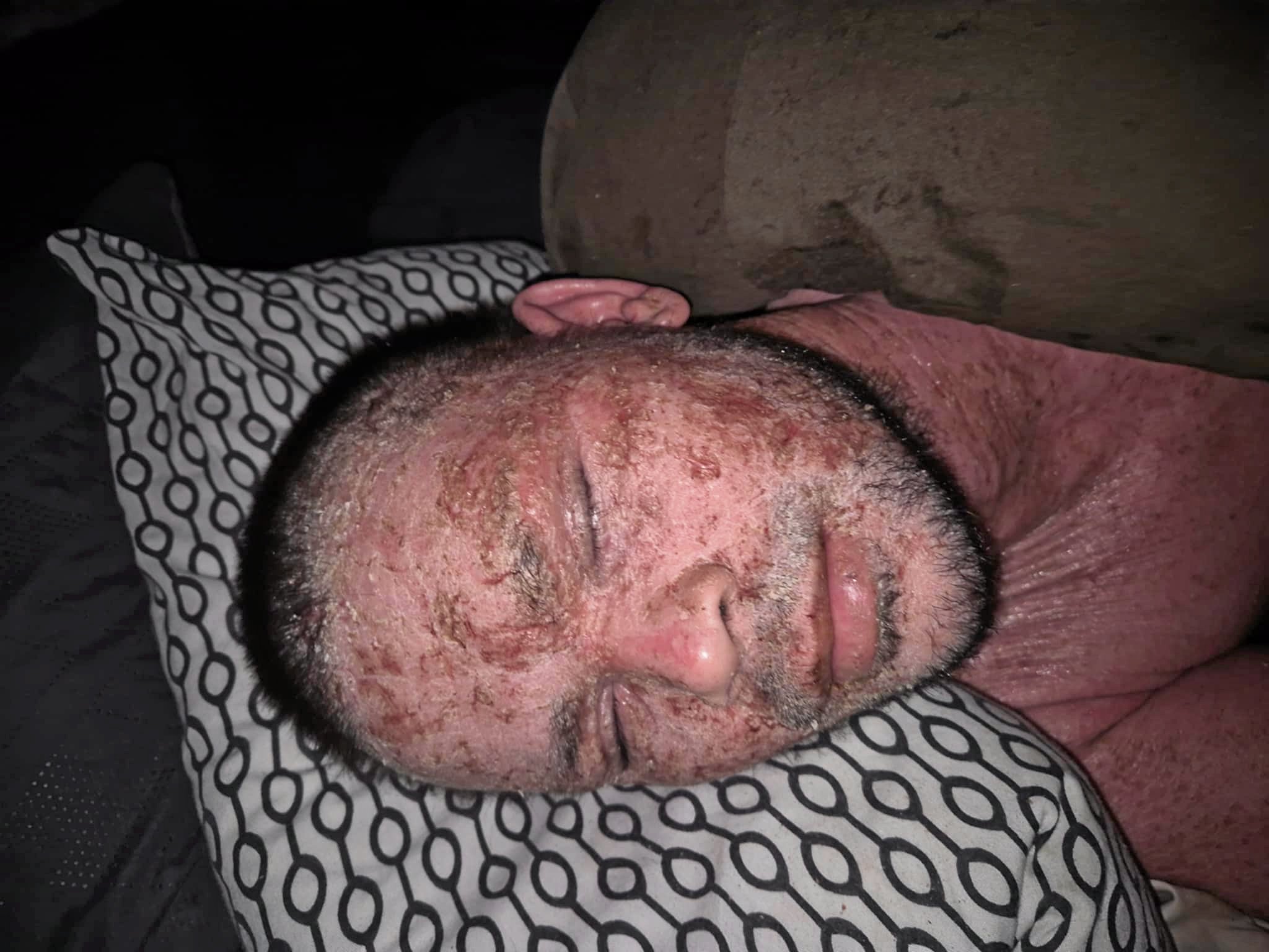 Livet lå foran Erik Gerlund med drømmejob, bryllupsplaner og et barn på vej. Men på få uger blev Erik Gerlunds krop hans værste fjende og dynen hans eneste tilflugt.