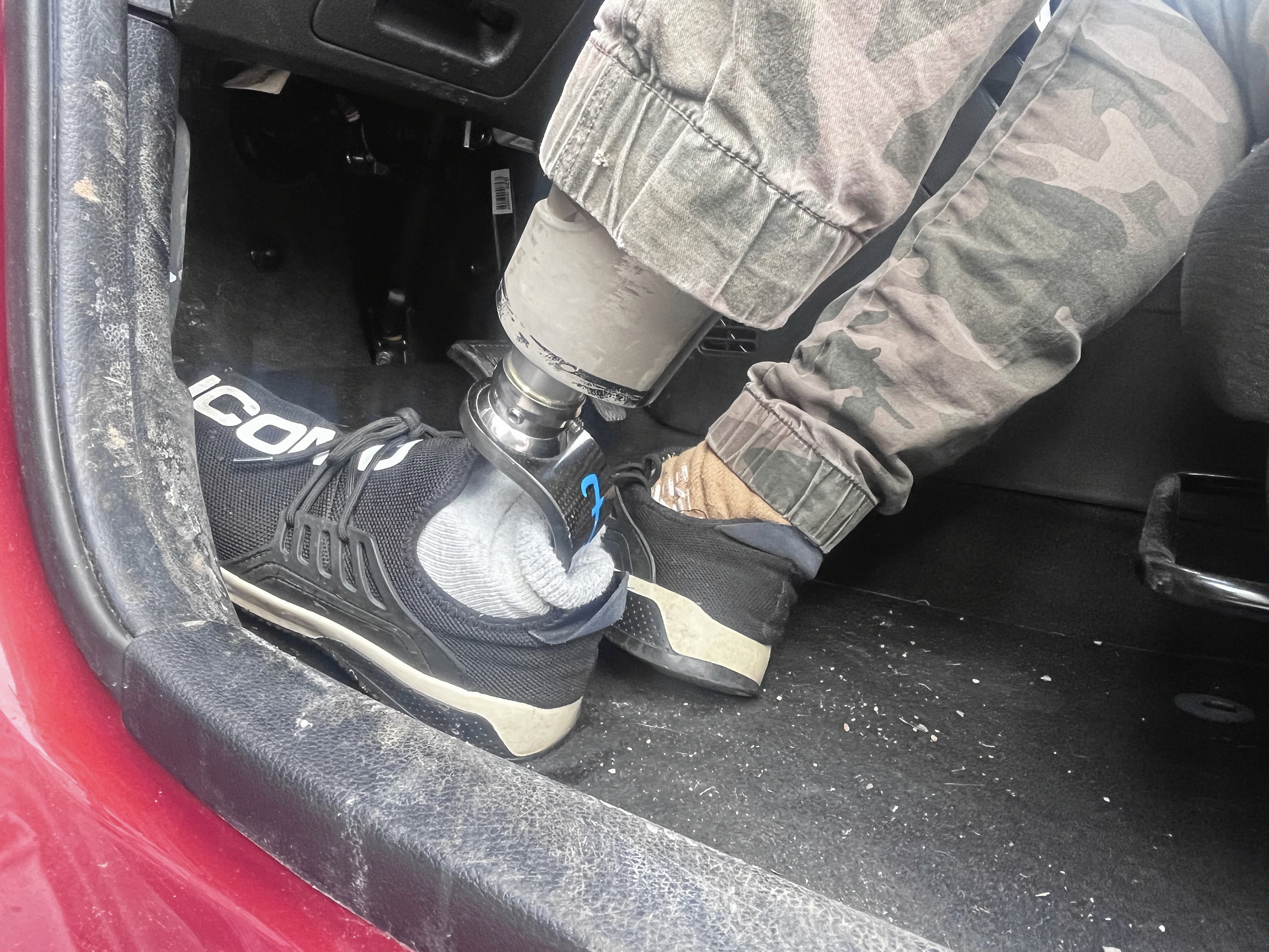 Kommunerne har for lidt viden om amputations- og proteseområdet, og det går udover sagsbehandlingen. Det mener Amputationsforeningens formand.