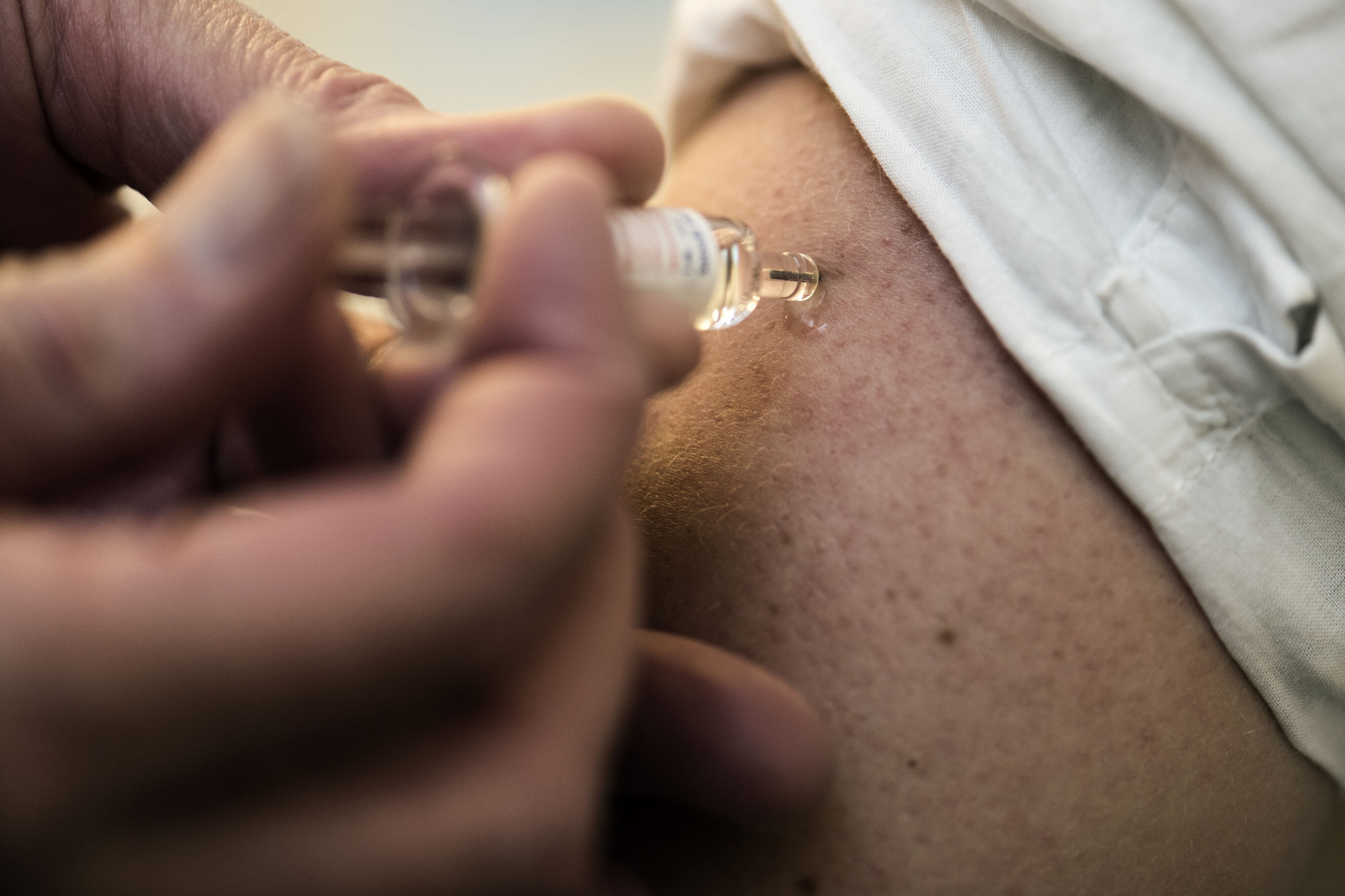 Kan en vaccine mod helvedesild forebygge demens og hjerte-kar-sygdom? Det forsøger forskere fra Herlev og Gentofte Hospital at kaste lys over. (Arkivfoto).