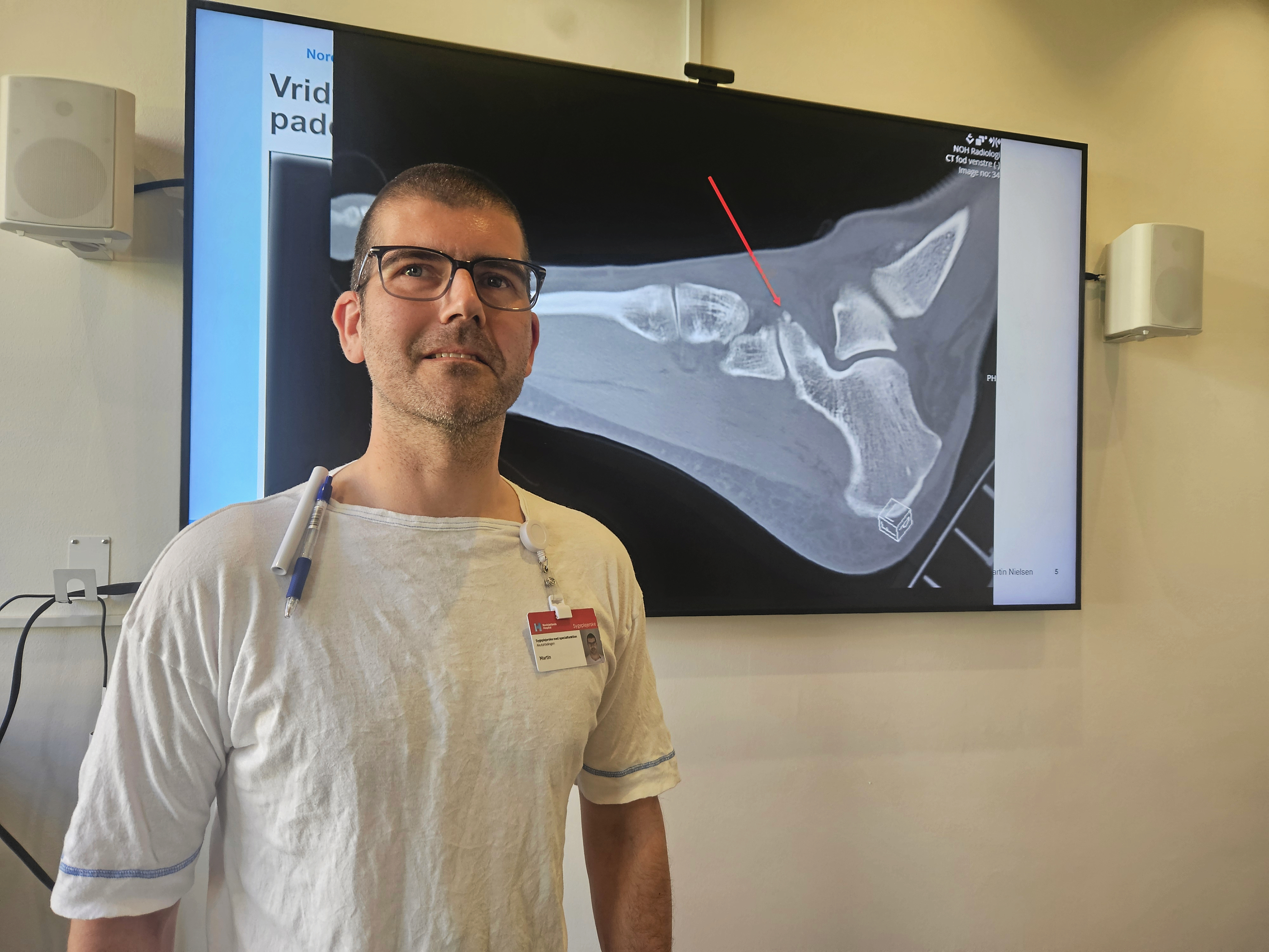 Behandlersygeplejerske Martin Nielsen, akutmodtagelsen på Nordsjællands Hospital er glad for at have fået et nyt støtteværktøj, når han skal behandle patienter med mistanke om knoglebrud.