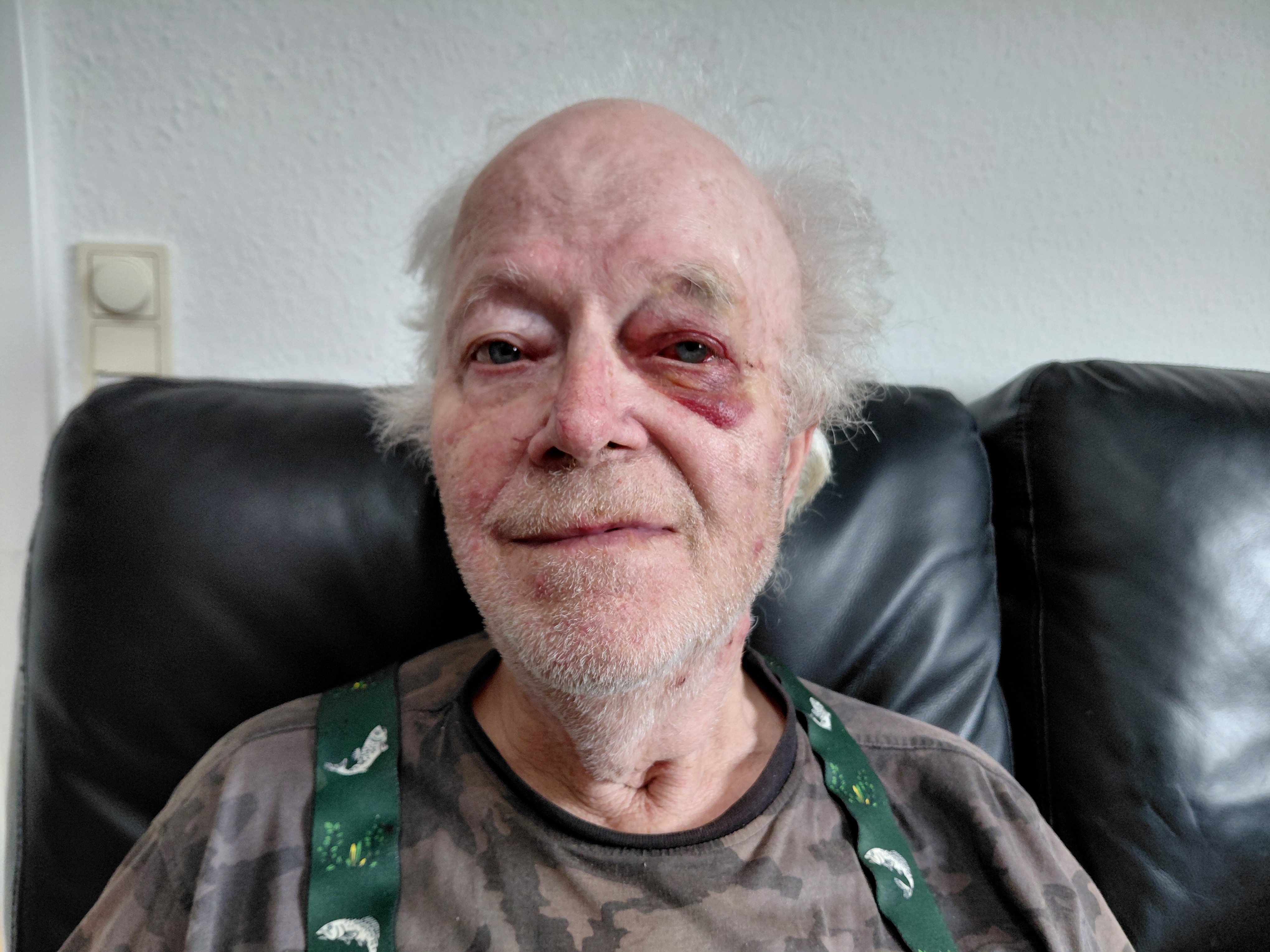 75-årige Ole Nielsen ville bare være venlig, da han sagde godmorgen til nogle unge mænd. Alligevel endte han med at blive overfaldet.