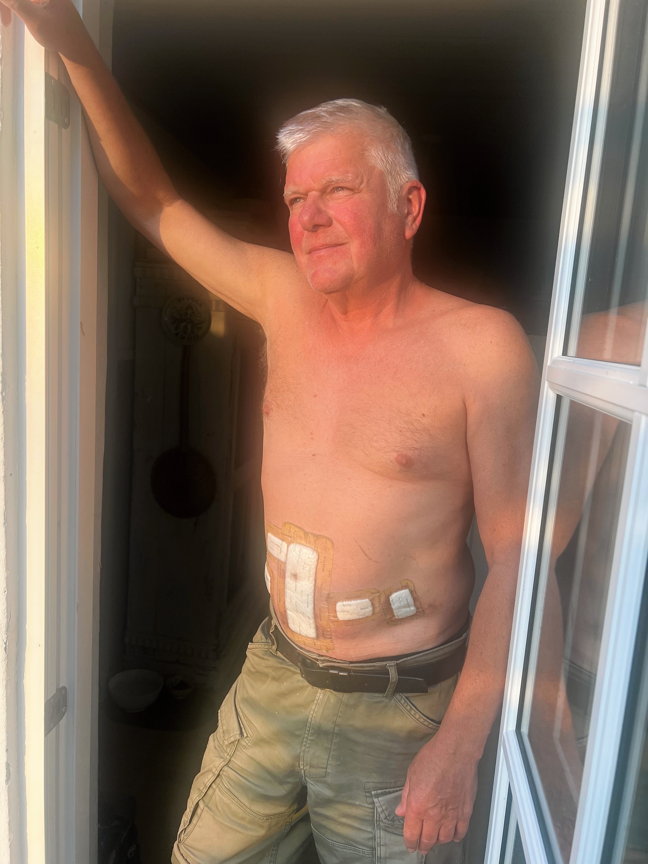 - Takket være psa blev min kræft opdaget, skriver Helge Wedel.